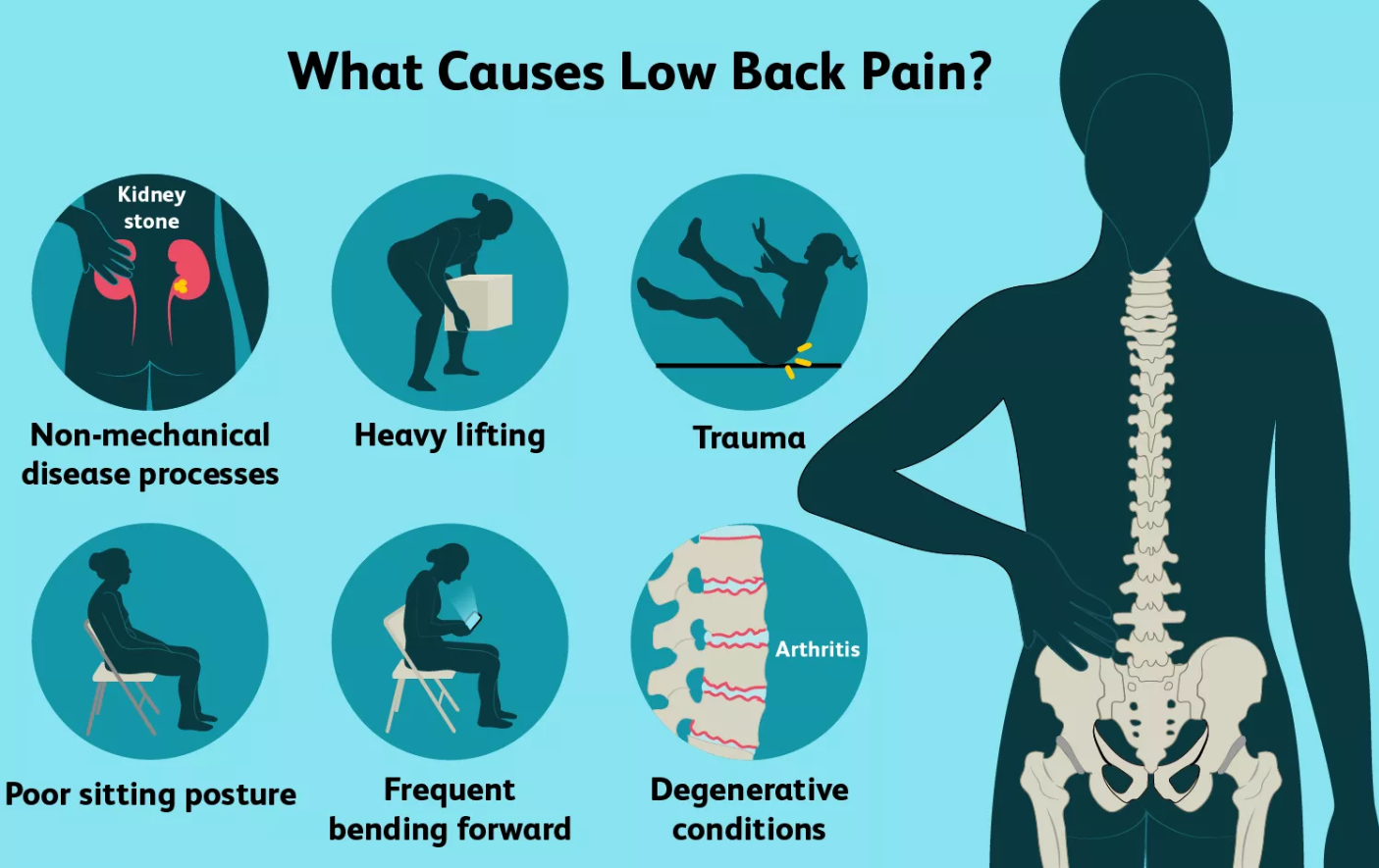 lower-back-pain