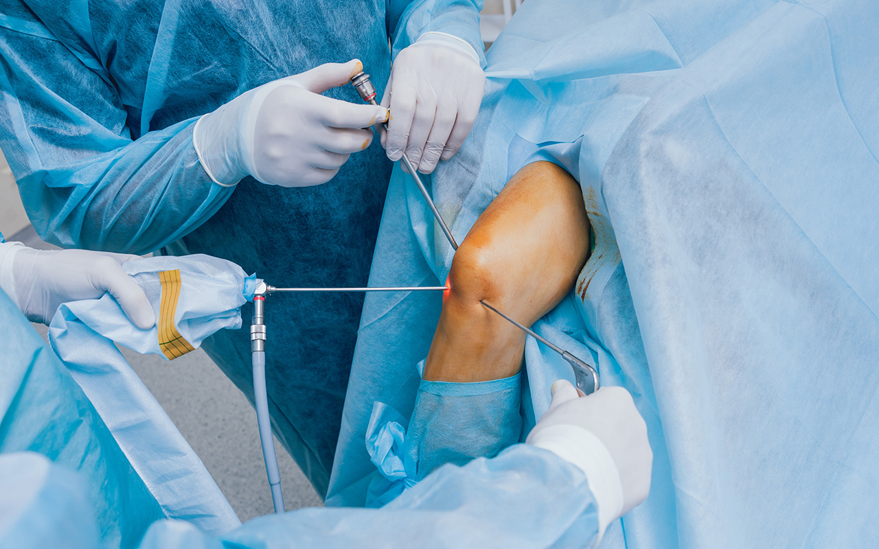 Knee Arthroscopy Conditions - Dr.S.Arumugam's Chennai Ortho