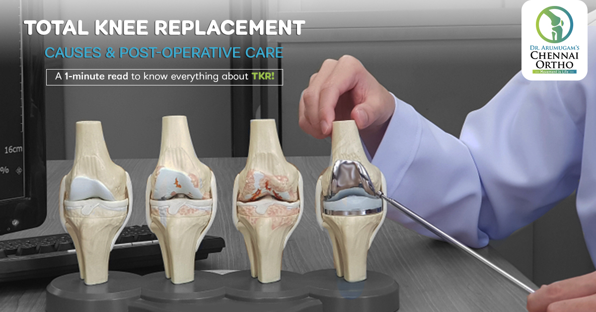 Total Knee Replacement Causes Post Operative Care D 