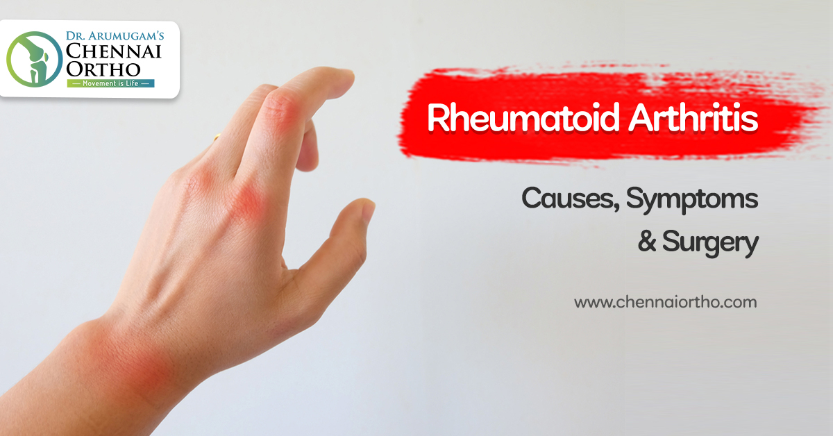 Rheumatoid Arthritis - Causes, Symptoms & Surgery - Dr.S.Arumugam's ...